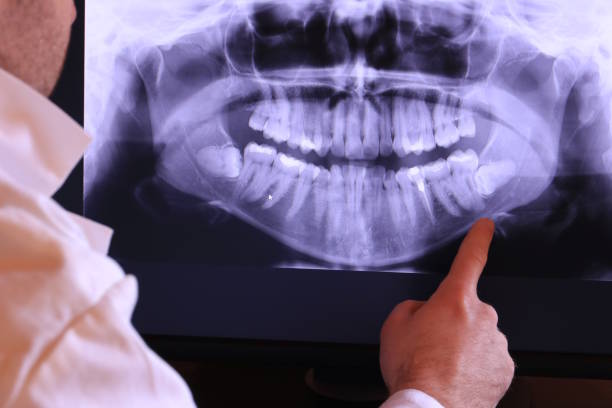 Best Emergency Treatment for Toothache in Bennington, NE