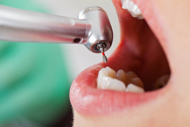 Best Emergency Dental Surgery in Bennington, NE